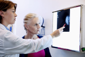 Mammographie resultat