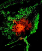 Fluorescence microscopy lights up nanopa...