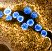 Nouveau coronavirus sars-cov-2